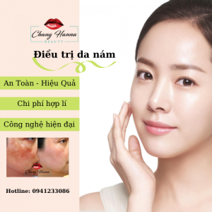 spa nào điều trị da nám